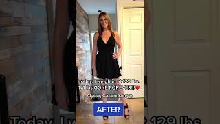 171 lbs Gone Forever!! | My Weight Loss Surgery Journey