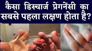 कैसा डिस्चार्ज प्रेगनेंसी का सबसे पहला लक्षण होता है?EARLY PREGNANCY DISCHARGE SYMPTOMS|Pregnancy|