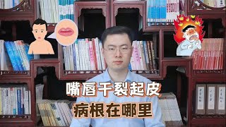 嘴唇干裂、起皮不总是因为缺水，病根在这里，请对号入座去调理【梁怡璋医生】