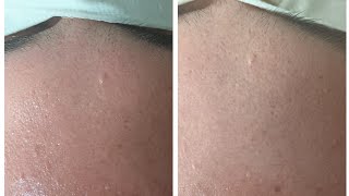 Discover the Ultimate Day Spa Experience in Fort Lauderdale | Top 10 Destinations