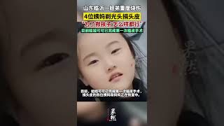 姐弟烧伤4位姨妈剃光头捐头皮，当事人：为了救孩子怎么样都行 #中国大陆 #暖心