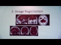 Data Analysis in MRI and PET/MRI Neuroimaging - Davide Poggiali