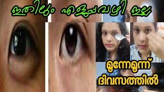 സ്പൂൺ കൊണ്ട് മൂന്ന് ദിവസത്തിൽ മാറ്റാം  /Remove Dark circles,Wrinkles,Puffy eyes ,Simple\u0026Effective