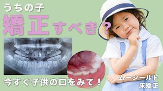 【小児矯正・前編】子供の歯並び早く治療が必要なのは？子供しかできない治療法とは？先生が解説します！【Ⅰ期治療】