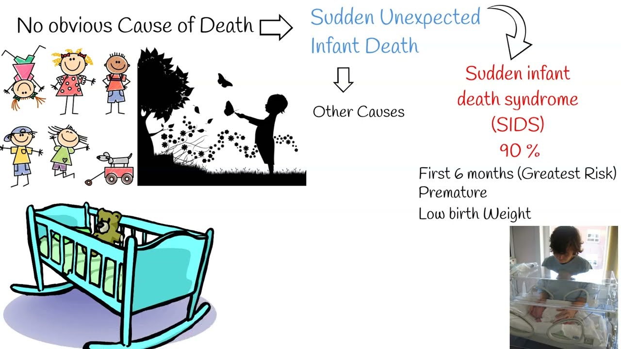 Sudden Infant Death Syndrome (SIDS) And Sudden Unexpected Infant Death ...