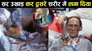 सर उखाड़ कर दूसरे शरीर में लगा दिया head transplant ! Earth Adventure in Hindi