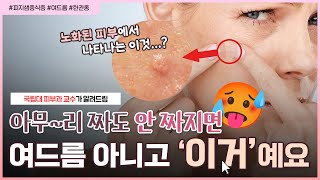 여드름이 아니라 피지샘이 증식한 거라고...?!😨｜'피지샘증식증' 원인부터 치료까지 다~ 알려드림👩🏻‍⚕️ - [언니네피부과]