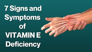 7 Signs and Symptoms of Vitamin E Deficiency | VisitJoy