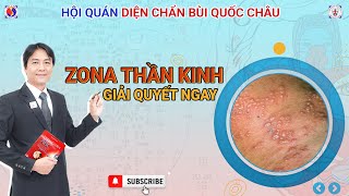 ZONA THẦN KINH và GIỜI LEO - Cách xử lý bằng Diện Chẩn Bùi Quốc Châu | G.V Huỳnh Tâm Bình chia sẻ