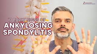 10 Early Signs of Ankylosing Spondylitis You Shouldn’t Ignore!