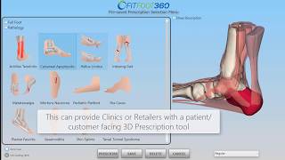 Introducing FITFOOT360 - Custom Orthotic Design for 3D Printing & Milling