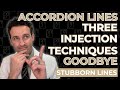 3 Injectable Techniques for Treating Stubborn Accordion Lines