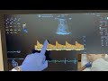 how to perform vexus scan venous excess ultrasound i dr. koratala i pocus