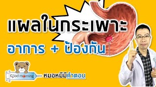 อาการและวิธีป้องกันแผลในกระเพาะอาหาร | หมอหมีมีคำตอบ