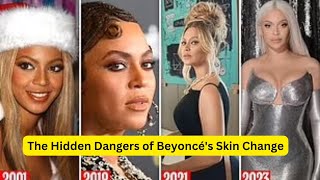 The Hidden Dangers of #Beyoncé's Skin Change: Skin Bleaching Exposed!