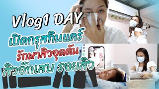 (เช็คเรตติ้ง)vlog1วัน ของกูรูยาหม่อง +  เปิดกรุ สกินแคร์รักษาสิวอุดตัน สิวอักเสบ รอยสิว มีอะไรบ้าง?