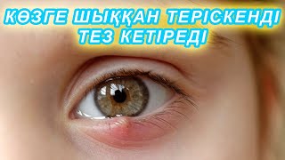 Көзге ТЕРІСКЕН ШЫҚҚАН кезде ОСЫНЫ ҮЗБЕЙ ЖАҒЫҢЫЗ, Теріскен кетіру, Керек арнасы