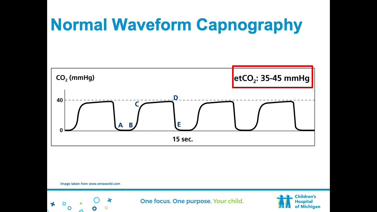 Waveform Capnography Implementation - YouTube