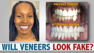 Will Veneers Look Fake?