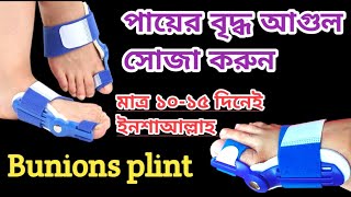 পায়ের বৃদ্ধ আঙ্গুল সোজা করার ডিভাইস। Bunion Split, Hallux-valgus-splint-left-right. পায়ের আঙ্গুল।