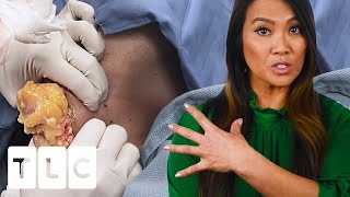 "It's Going To Be Satisfying": The Most Beautiful Pops | Dr. Pimple Popper: This is Zit