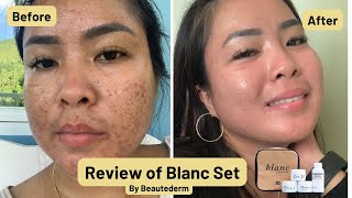 Blanc Set by Beautederm Product Review | Mrs. Dee Beauty VLOGS