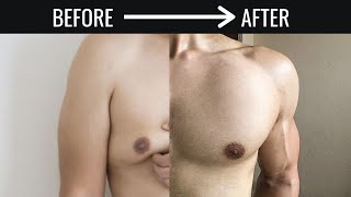 Burn CHEST FAT Forever (5 आसान Steps): Man Boobs & Gynecomastia Solution!
