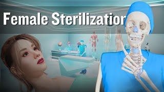 Female Sterilization: Tubal Ligation Procedure | Tubectomy  (3D Animation)