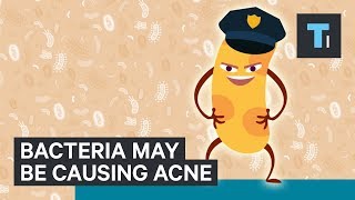 Science Of Why Some People Have Worse Acne