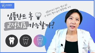 임플란트 하기 전 이것 꼭 확인하세요!!