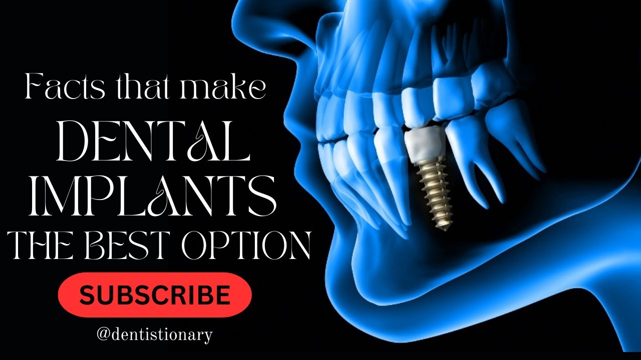 Dental Implants Youtube