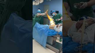 IMG 1060 膝关节置换手术#hospital #doctor #satisfying