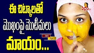 ఈ చిట్కాలతో మొఖం పై మొటిమలు మాయం || Health \u0026 Beauty Tips || Vanitha TV