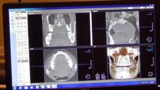 Rayscan Imaging Software Overview