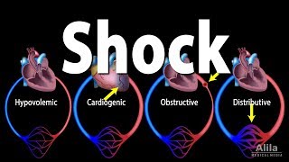 Shock Pathology Of Different Types Animation