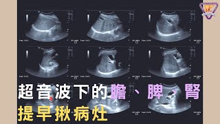 0609超音波下的膽、脾、腎 提早揪病灶｜好心肝˙好健康