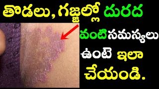 ఇలాచేస్తే చర్మ సమస్యలు మటుమాయం | Skin Infection In Telugu | Skin Disease | Itching