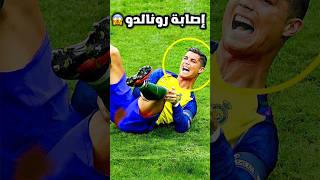 أخطر إصابة في تاريخ كرة القدم 😱⚽️ممنوع ل ضعاف القلوب 🔞