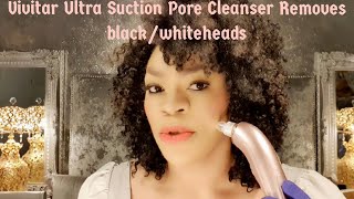 Vivitar Ultra Suction Pore Cleanser| Removes black/whiteheads| Reduces fine line @lavishv6648 Review