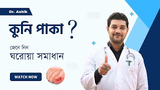 নখের কুনি পাকা ও নখের ব্যাথা দূর করারকার্যকরী উপায় | নখের কুনি | ingrown toenail