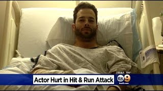 Actor/Model Attacked While Trying To Bring Thanksgiving Dinner To Friend