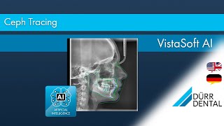 VistaSoft AI Ceph - Tracing