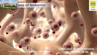 Understanding Leukemia – CIMS Hospital