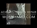 Dr. Momaya demonstrates how to perform an achilles tendon repair