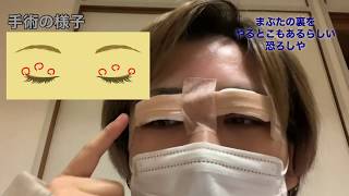 【眼瞼下垂】手術当日～3日目 グロいかも