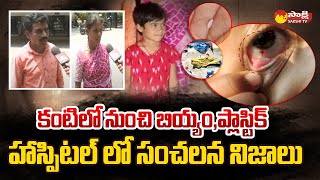 Mahabubnagar Incident | Plastic Pieces and Rice Grains From Eye @SakshiTV