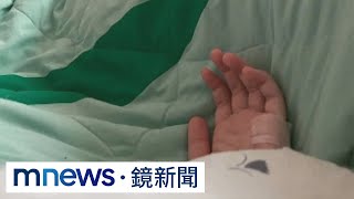 為母則強護胎兒！　中風孕婦清醒動手術移除血栓｜#鏡新聞