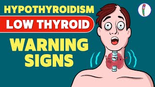 Signs that you have a Low Thyroid Level | Hypothyroidism - Signs & Symptoms | Thyroid disease