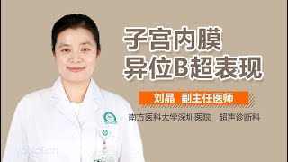 子宫内膜异位B超表现 有来医生