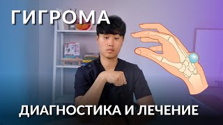 Гигрома | Диагностика, лечение